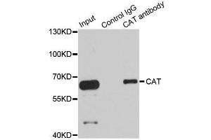 Immunoprecipitation analysis of 100ug extracts of HepG2 cells using 3ug CAT antibody. (Catalase antibody  (AA 1-225))
