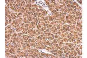 IHC-P Image PRKCSH antibody detects PRKCSH protein at cytosol on U87 xenograft by immunohistochemical analysis. (PRKCSH antibody)