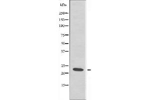 Western blot analysis of extracts from JurKat cells using RPS7 antibody. (RPS7 antibody  (C-Term))
