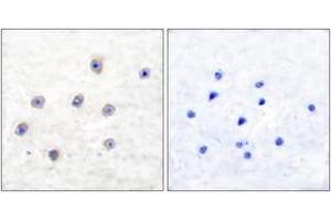 Immunohistochemistry (IHC) image for anti-Tyrosine Hydroxylase (TH) (AA 1-50), (pSer62) antibody (ABIN1531206)