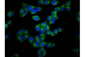 Immunofluorescence staining of Hela cells with ABIN7153647 at 1:133, counter-stained with DAPI. (Gasdermin A antibody  (AA 64-172))
