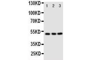 Anti-CXCR4 antibody, Western blotting Lane 1: M231 Cell Lysate Lane 2: MCF-7 Cell Lysate Lane 3: JURKAT Cell Lysate (CXCR4 antibody  (N-Term))
