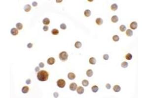 Immunocytochemistry of SLC35D2 in HeLa cells with SLC35D2 antibody at 5 ug/ml. (Solute Carrier Family 35 (UDP-GlcNAc/UDP-Glucose Transporter), Member D2 (SLC35D2) (C-Term) antibody)