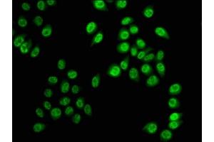 Immunofluorescence staining of Hela cells with ABIN7139619 at 1:5, counter-stained with DAPI. (HIST1H3A antibody  (pSer28))