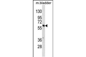 Western blot analysis in mouse bladder tissue lysates (35ug/lane). (SNX30 antibody  (C-Term))
