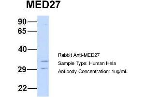 Host: Rabbit Target Name: MED27 Sample Type: Hela Antibody Dilution: 1. (MED27 antibody  (Middle Region))