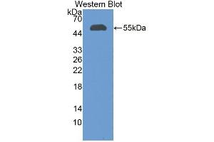 Detection of Recombinant CFI, Human using Polyclonal Antibody to Complement Factor I (CFI) (Complement Factor I antibody  (AA 28-243))