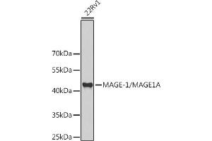 Western blot analysis of extracts of 22Rv1 cells, using MAGE-1/MA antibody (ABIN6132325, ABIN6143435, ABIN6143436 and ABIN6221133) at 1:1000 dilution. (MAGEA1 antibody  (AA 1-309))