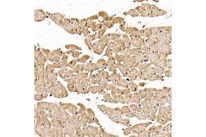 Immunohistochemistry of paraffin-embedded rat heart using RC Rabbit pAb (ABIN6129452, ABIN6146811, ABIN6146812 and ABIN6220955) at dilution of 1:150 (40x lens). (RCAN1 antibody  (AA 60-245))