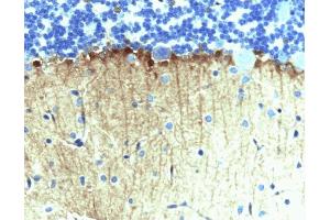 Immunohistochemical staining on rat cerebellum, formalin-fixed paraffin embedded tissue, with citrate pre-treatment (40X magnification).