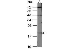 WB Image Sample (30 ug of whole cell lysate) A:NIH-3T3 12% SDS PAGE antibody diluted at 1:1000 (UBE2C antibody)