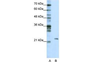 Western Blotting (WB) image for anti-Mitochondrial rRNA Methyltransferase 1 Homolog (MRM1) antibody (ABIN2462305) (MRM1 antibody)
