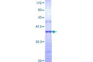 NR4A3 Protein (AA 414-521) (GST tag)