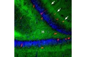 Expression of β3-Adrenoceptor in rat hippocampusImmunohistochemical staining of rat hippocampal dentate gyrus using Anti-β3-Adrenergic Receptor (extracellular) Antibody (ABIN7042907, ABIN7043912 and ABIN7043913), (1:100), (green). (Adrenergic, beta-3-, Receptor (ADRB3) Peptide)