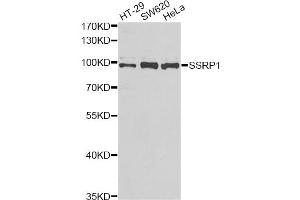 Western blot analysis of extracts of various cell lines, using SSRP1 antibody (ABIN2560151) at 1:1000 dilution. (SSRP1 antibody)