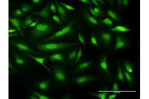 Immunofluorescence of monoclonal antibody to CALML3 on HeLa cell. (CALML3 antibody  (AA 1-149))