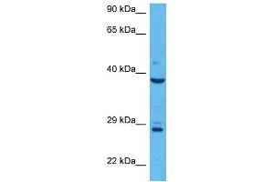 Host:  Rabbit  Target Name:  AGER  Sample Tissue:  Human MCF7 Whole Cell  Antibody Dilution:  1ug/ml (RAGE antibody  (N-Term))