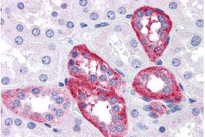 ABIN190762 (5µg/ml) staining of paraffin embedded Human Kidney. (APH1A antibody  (Internal Region))