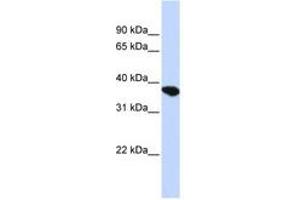 Image no. 1 for anti-ST8 alpha-N-Acetyl-Neuraminide alpha-2,8-Sialyltransferase 4 (ST8SIA4) (AA 180-229) antibody (ABIN6741038) (ST8SIA4 antibody  (AA 180-229))