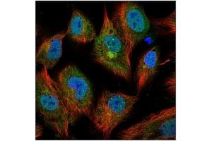 Image no. 3 for anti-Interleukin 6 (IL6) antibody (ABIN181728) (IL-6 antibody)