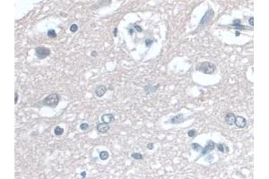 Immunohistochemistry (IHC) image for anti-Coenzyme Q6, Monooxygenase (COQ6) (AA 1-468) antibody (ABIN7444298)
