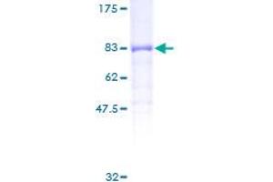 PP5 Protein (AA 1-499) (GST tag)