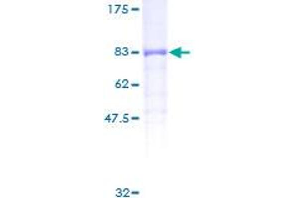 PP5 Protein (AA 1-499) (GST tag)