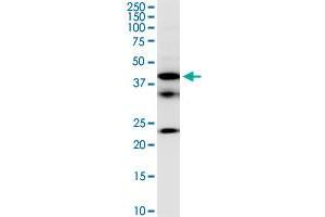 FCRLB monoclonal antibody (M01), clone 2F8. (FCRLB antibody  (AA 89-174))