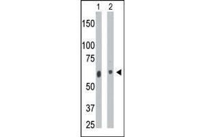 The anti-CERK Pab is used in Western blot to detect CERK in mouse heart tissue lysate (Lane 1) and A2058 cell lysate (Lane 2).