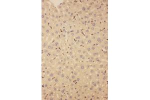 Anti-CD68 antibody,  IHC(P) IHC(P): Mouse Liver Tissue (CD68 antibody  (Middle Region))