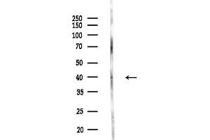 anti-Ribosomal Modification Protein RimK-Like Family Member B (RIMKLB) (Internal Region) antibody