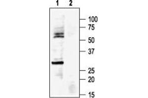 Western blot analysis of rat heart membranes: - 1. (KCNJ8 antibody  (C-Term, Intracellular))