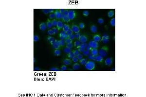 Sample Type :  Human Capan1 cells (Pancreatic cancer cell line)  Primary Antibody Dilution :  1:300  Secondary Antibody :   Anti-rabbit-AlexaFluor-488  Secondary Antibody Dilution :  1:200  Color/Signal Descriptions :  ZEB: Green DAPI: Blue  Gene Name :  ZEB1  Submitted by :  Dr. (ZEB1 antibody  (N-Term))