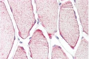 ABIN184954 (3. (TRIM54 antibody  (C-Term))