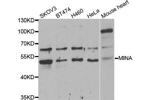 Western blot analysis of extracts of various cell lines, using MINA antibody (ABIN5974006) at 1/1000 dilution. (MINA antibody)