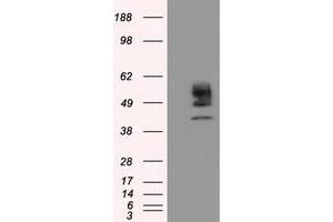 Image no. 3 for anti-Cytochrome P450, Family 1, Subfamily A, Polypeptide 2 (CYP1A2) antibody (ABIN1497712) (CYP1A2 antibody)