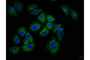 Immunofluorescence staining of A549 cells with ABIN7155952 at 1:100, counter-stained with DAPI. (HAS1 antibody  (AA 151-271))