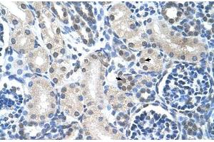 Immunohistochemical staining (Formalin-fixed paraffin-embedded sections) of human kidney with LOR polyclonal antibody . (LOR antibody  (AA 58-107))