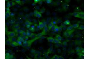 Image no. 9 for anti-Transforming, Acidic Coiled-Coil Containing Protein 3 (TACC3) antibody (ABIN1498097) (TACC3 antibody)