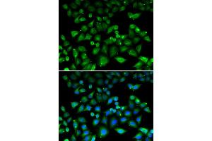 Immunofluorescence analysis of HeLa cell using NHLRC1 antibody. (NHLRC1 antibody)