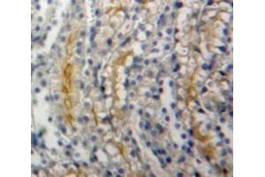 Used in DAB staining on fromalin fixed paraffin-embedded Kidney tissue (ADCY1 antibody  (AA 303-569))