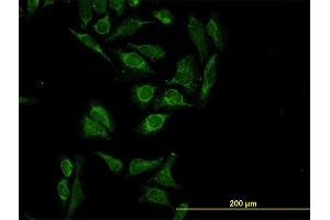 Immunofluorescence of monoclonal antibody to HTRA2 on HeLa cell. (HTRA2 antibody  (AA 359-458))
