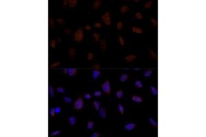 Immunofluorescence analysis of U-2 OS cells using BRE Polyclonal Antibody (ABIN7265912) at dilution of 1:100 (40x lens). (BRE antibody  (AA 51-229))
