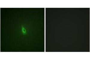 Immunofluorescence (IF) image for anti-Inositol 1,4,5-Trisphosphate Receptor, Type 1 (ITPR1) (AA 1566-1615), (pSer1598) antibody (ABIN1531671)