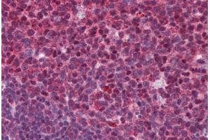 Human Tonsil: Formalin-Fixed, Paraffin-Embedded (FFPE) (SENP1 antibody  (C-Term))