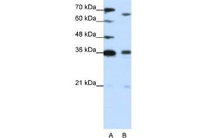 WB Suggested Anti-PRDM13 Antibody Titration:  1. (PRDM13 antibody  (C-Term))