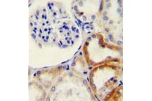 Immunohistochemistry analysis in formalin fixed and paraffin embedded human kidney tissue reacted with HYAL2 Antibody (C-term) followed which was peroxidase conjugated to the secondary antibody and followed by DAB staining. (HYAL2 antibody  (C-Term))