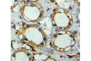 Used in DAB staining on fromalin fixed paraffin-embedded Kidney tissue (Neuregulin 2 antibody  (AA 101-211))