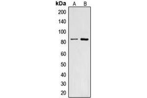 Western blot analysis of CNGA2 expression in HepG2 (A), A431 (B) whole cell lysates.