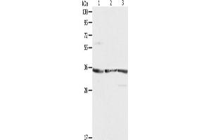 Western Blotting (WB) image for anti-Ribosomal Protein, Large, P0 (RPLP0) antibody (ABIN2422122) (RPLP0 antibody)